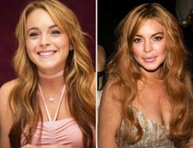 Lindsay Lohan Before and After